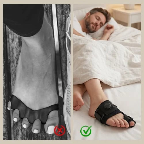 Adjustable Bunion Corrector